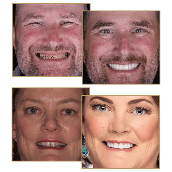 A collage of Country Day Dental patients with smile design